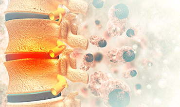 Bone & Musculoskeletal Tumours