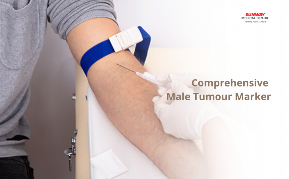 Comprehensive Cancer Marker Screen (Male)