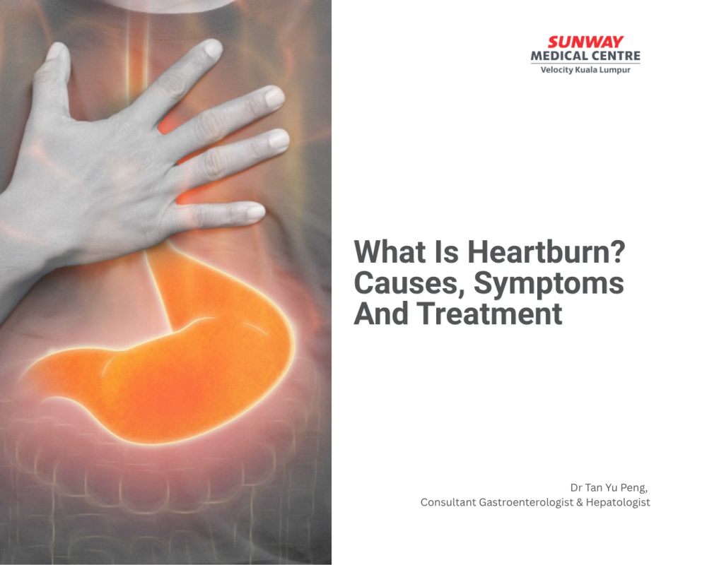 什么是胃灼热（烧心）？原因、症状与治疗方法