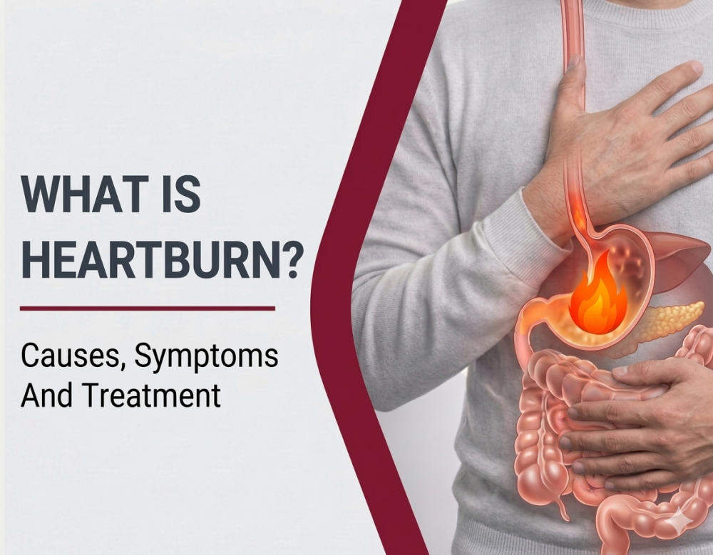 What Is Heartburn? Causes, Symptoms And Treatment