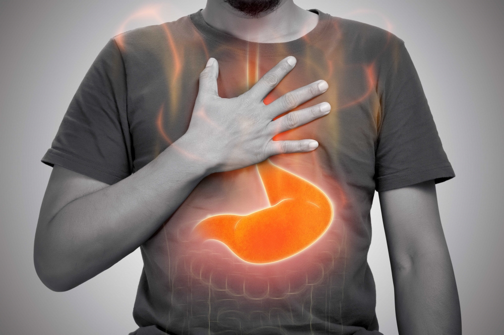 What Is Heartburn? Causes, Symptoms And Treatment