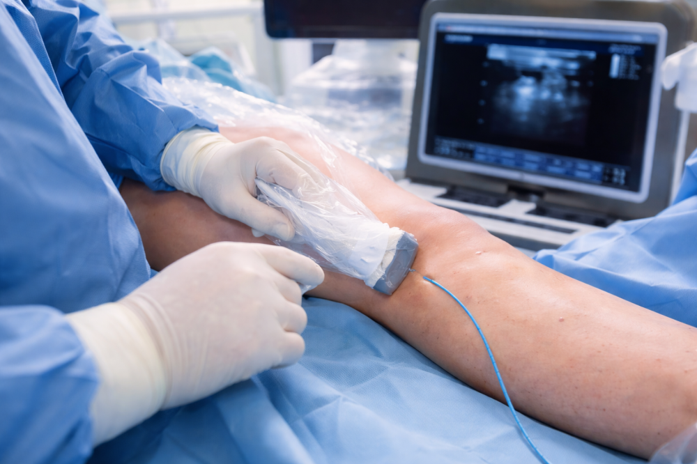 Minimally Invasive Mitral Valve Replacement