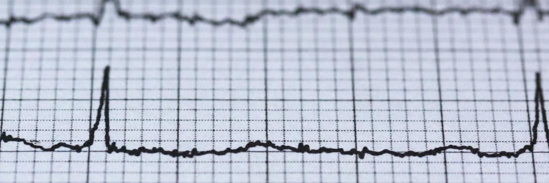 Electrophysiology